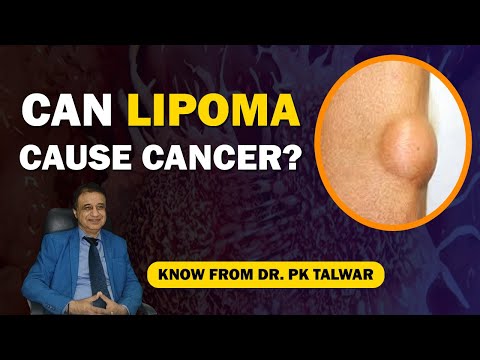 Can Lipoma Cause Cancer? Lipoma: Causes, Symptoms, Types, Treatment in English By Dr. PK Talwar