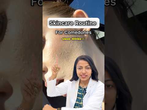 Skincare Routine for Comedonal Acne #comedones  #acne #skincareroutine