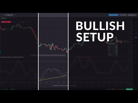 download lagu mp3 mp4 Bullish Divergence, download lagu Bullish Divergence gratis, unduh video klip Download Bullish Divergence Mp3 dan Mp4 Music Gratis