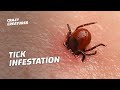 WARNING: The Most Horrific Tick Infestations