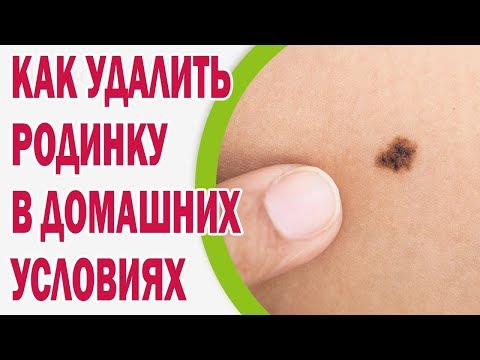 Осветлить пигментные пятна дома Отбеливание лица картошка