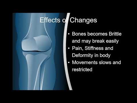 Bone and Dental Health - MOH TV (S01, E79)