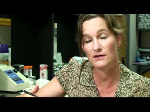 PTSD and Vagus Nerve Stimulation