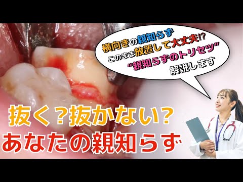 生命歯学科 その親知らず本当に抜くの？歯医者が解説！親知らずを抜いた方がいいの？抜かなくてもいいの？“親知らずのトリセツ”を解説します🦷