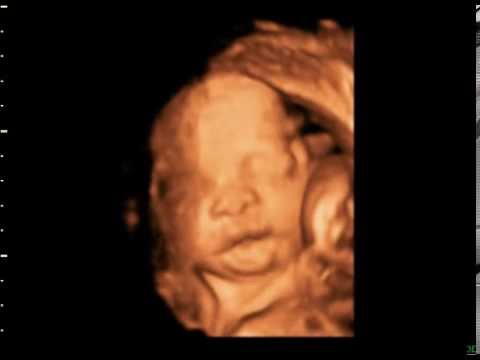 B05013 15 04 07 4 001