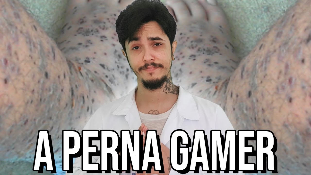 O incidente da Gamer leg (esse foi ruim)