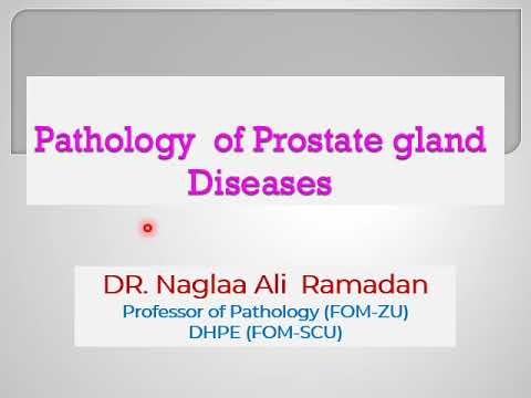 Prostatitis férfiakban a gyógynövények kezelése