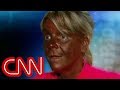 'Tanning mom' turns 'weird and pale' 'Tanning mom' turns 'weird and pale'