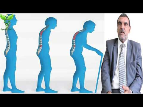 علاج هشاشة العظام بالاعشاب والتغذية  Osteoporosis Dr mohamed al fayed  محمد الفايد  fayed
