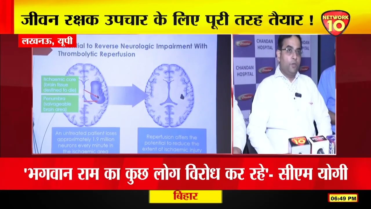 लखनऊ, यूपी | चंदन अस्पताल में मनाया गया विश्व स्ट्रोक दिवस | World Stroke Day | Network 10 UP
