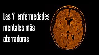 Las 7 enfermedades mentales más aterradoras