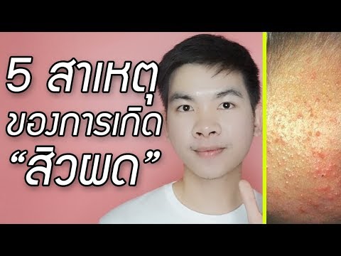 การลดลงของอาการแรง เมนูสำหรับสัปดาห์เพื่อเพิ่มความแข็งแรง