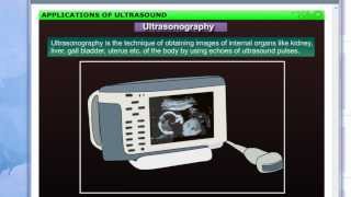 Applications of Ultrasound | Class 9th | CBSE | Chapter 12th | Sound