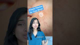 Do pimple patches work?