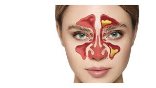 Part 2 antihistamine tutorial 2025B