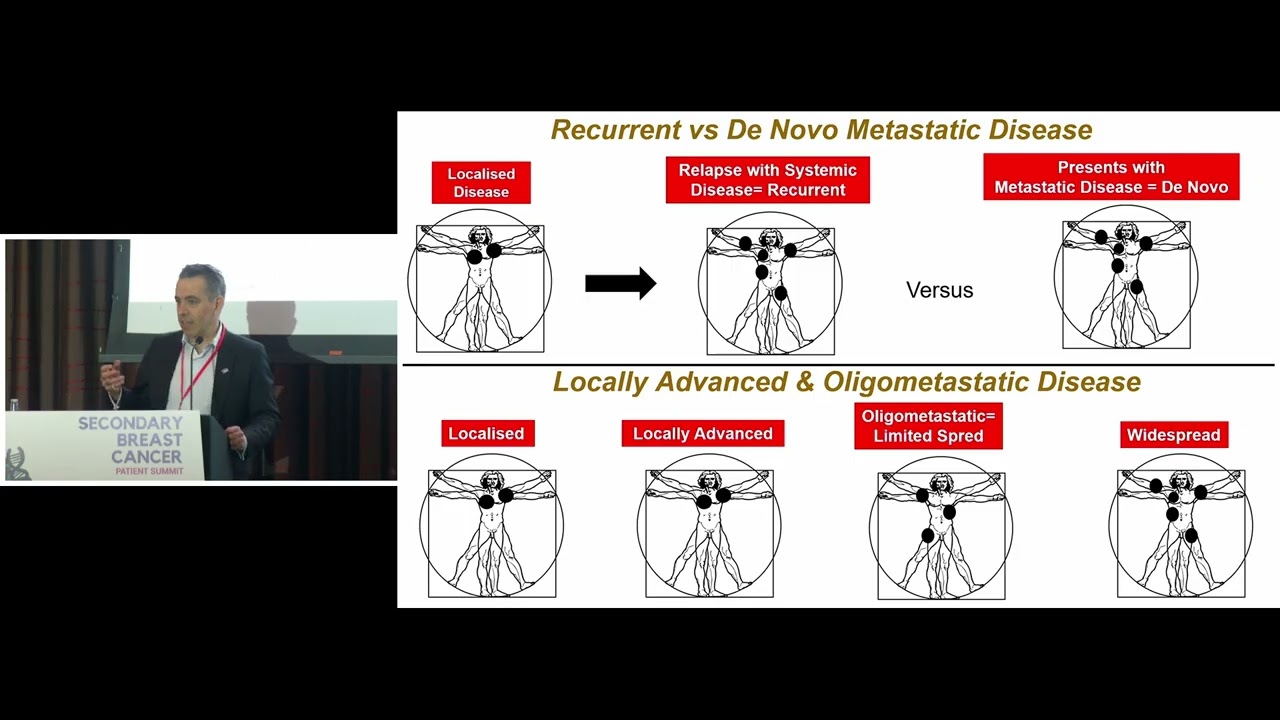 SBC Patient Summit 2026: An Overview of Secondary (Metastatic) Breast Cancer