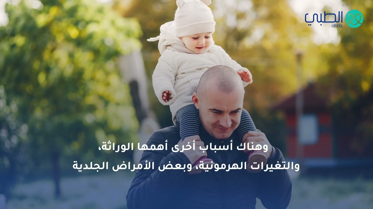 تساقط الشعر عند الرجال