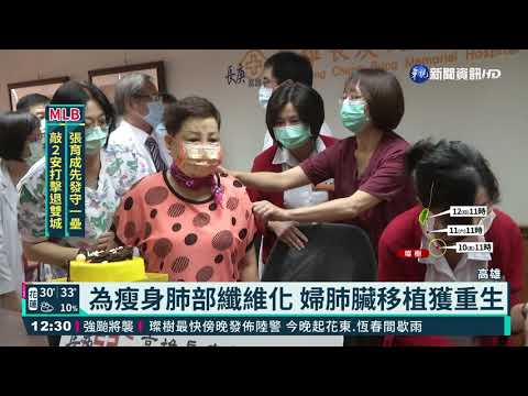 為瘦身肺部纖維化 婦肺臟移植獲重生