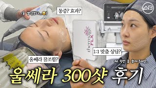 울쎄라 시술 꿀조합✨