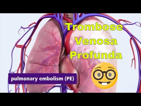 Deep vein thrombosis (DVT) and pulmonary embolism (PE).