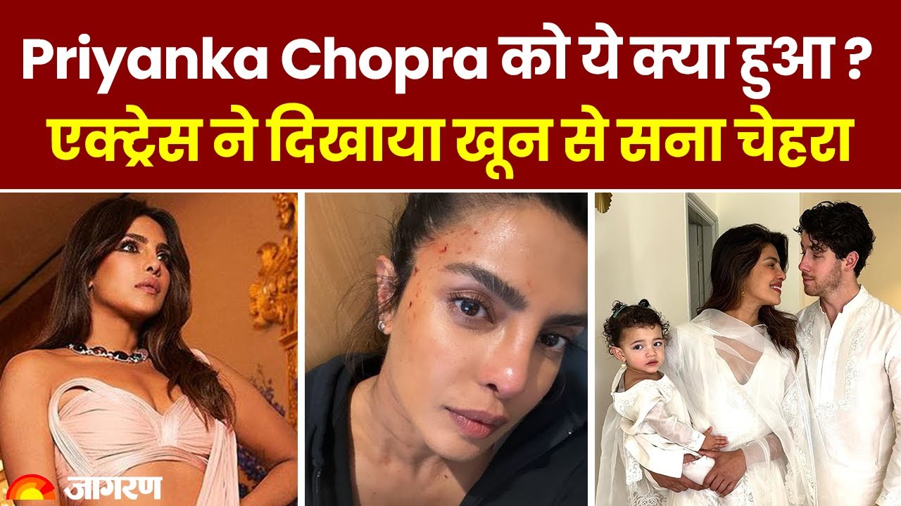 Priyanka Chopra को ये क्या हुआ, एक्ट्रेस ने दिखाया खून से सना चेहरा, शूटिंग के दौरान ऐसी हो गई हालत