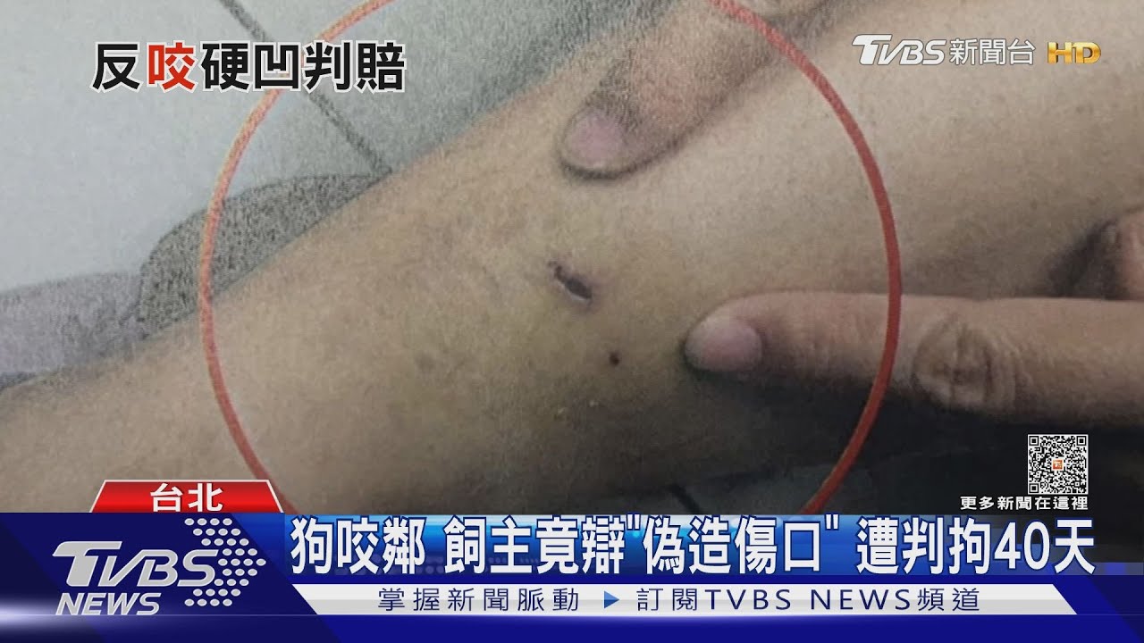 狗咬鄰！飼主竟辯「偽造傷口」　遭判拘40天 