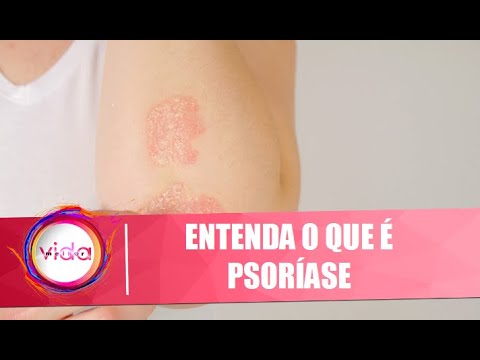 Saiba o que é psoríase e como tratar – Vida Melhor – 20/11/20