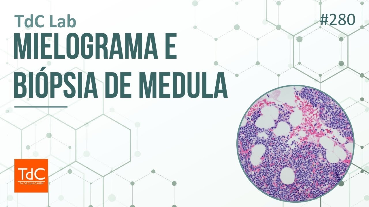 Episode 280: Myelogram and bone marrow biopsy