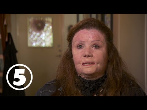 Sofias änglar | "Han tände eld på mig och barnet"