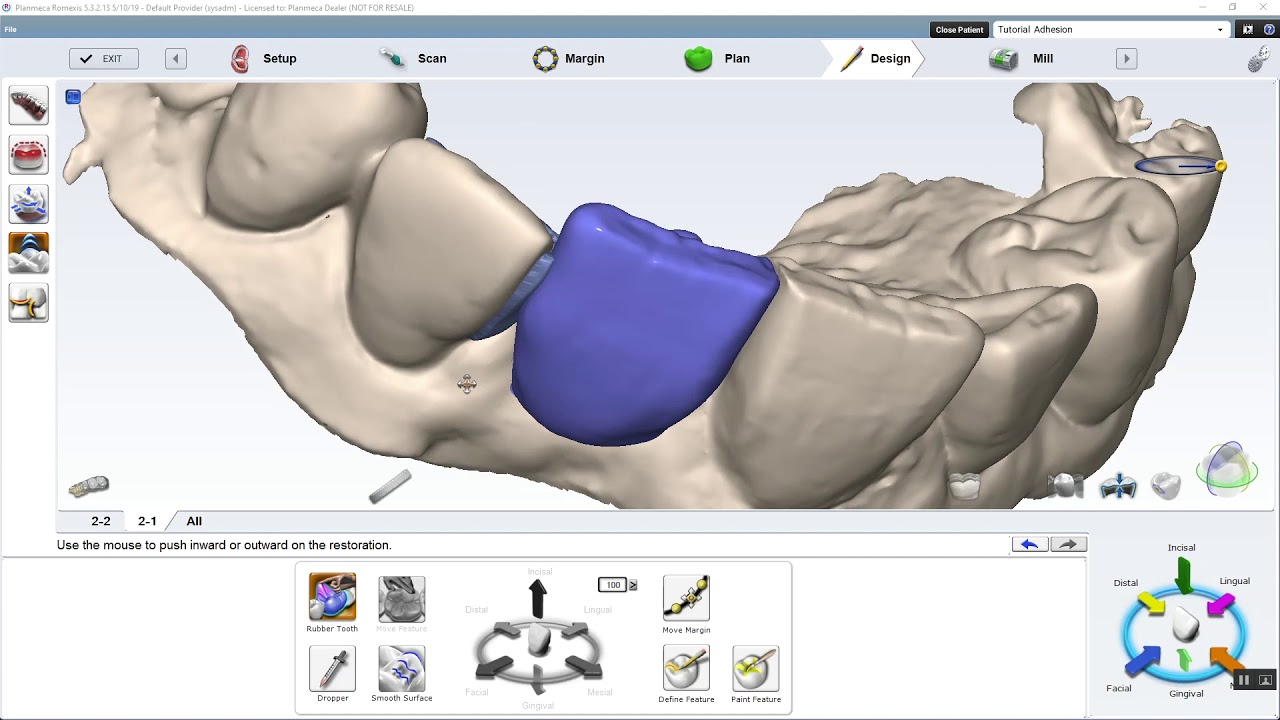 adhesion bridge tutorial Planmeca