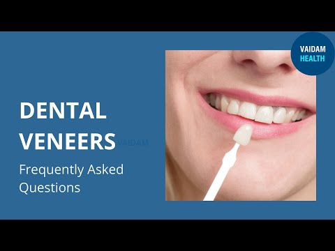 Dental Veneers- Frequently Asked Questions