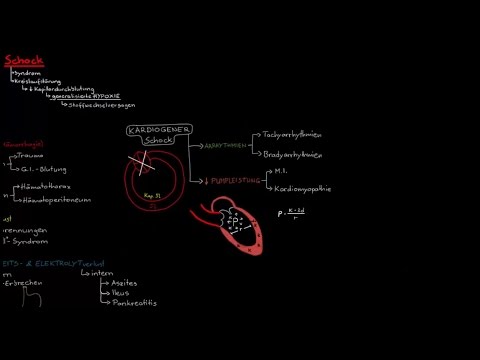 Kreislaufschock (3/7) - Kardiogener Schock (Vorschau)