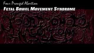 Four Pronged Abortion - Fetal Bowel Movement Syndrome