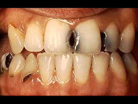 download lagu mp3 mp4 Paletas Picadas, download lagu Paletas Picadas gratis, unduh video klip Paletas Picadas