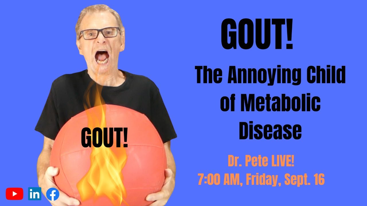 Understanding Gout: The Complex Relationship with Metabolic Disease ...