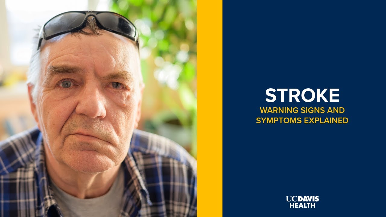 Thumbnail preview of Stroke Symptoms and Warning Signs - "BE FAST" Explained by a Neurologist | UC Davis Health