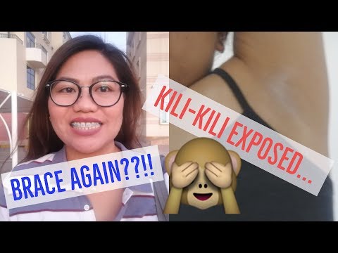 Mawalan ng Timbang sa isang linggo sa parmasya sa Nizhny Novgorod Artistang babae mula sa pelikula bilang isang manipis na Voronin