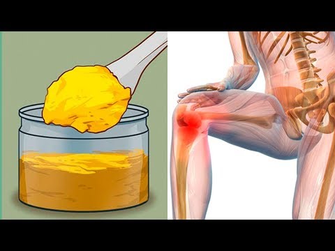 Las tomografías computarizadas de la rodilla en Kazán La piel en las articulaciones de los dedos embrutece