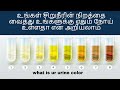 Colors Of Urine And What They Mean 10 Colors