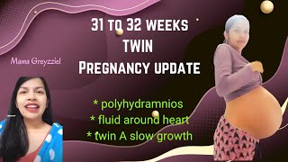 31 to 32 weeks TWIN pregnancy update | Mama Greyzziel