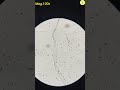 Condom Under Microscope TULO Microscope Shorts Underthemicroscope Condom