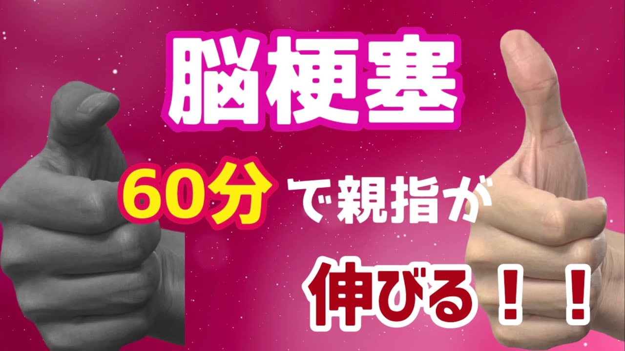 事例4. 脳卒中（手の機能変化）の事例動画