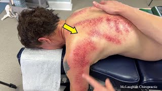 Never In A Million Years...Unbelievable Buildup 😳*CRACKING* & Cleaning A Toxic Back FREES Man!