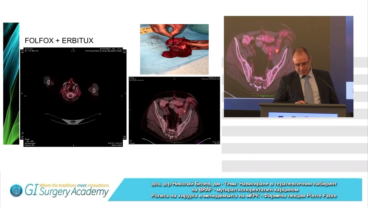 Navigating the therapeutic labyrinth of BRAF-mutated CRC (Part 1)
