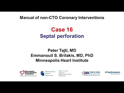 Case 16: PCI Manual - Septal perforation