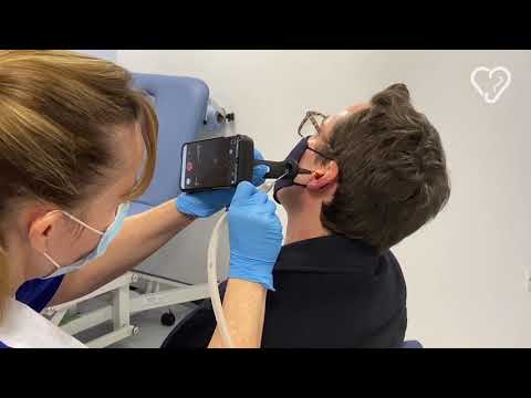 Large ear wax plug removal using microsuction with the Tympa system