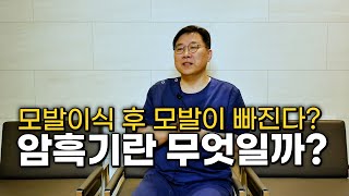 이식 후 다시 탈모가?? 모발이식 후…