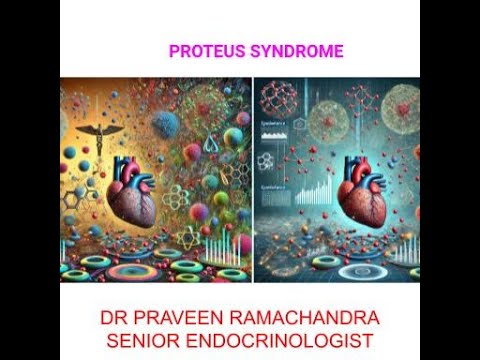 proteus syndrome