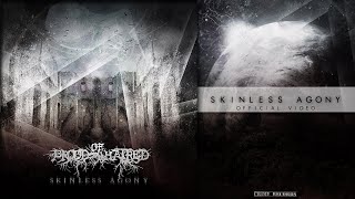 Brood Of Hatred - Skinless Agony (OFFICIAL VIDEO)