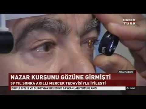 Op. Dr. Serhan Gazyağcı – Habertürk – Akıllı Lens Tedavisi